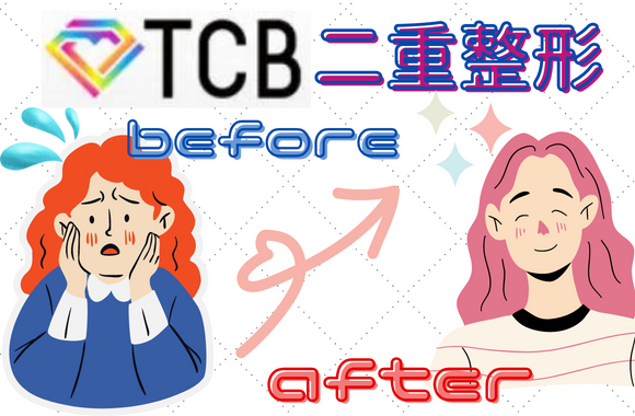 TCB東京中央美容外科の二重整形を受けた人のビフォーアフター